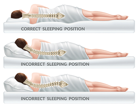 kako spavati kad vas bole ledja i vrat pozicije za spavanje