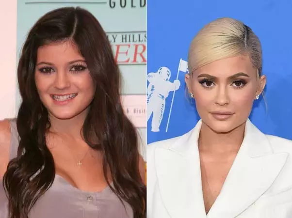 prirodna kosa poznatih dama Kylie Jenner