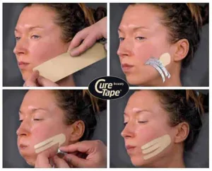 kinezioloske trake za lice kinezioloske trake za lice